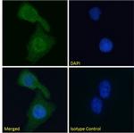 Cardiac Troponin I Chimeric Recombinant Mouse Monoclonal Antibody (scFv 180)