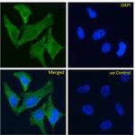 TrkA Chimeric Recombinant Rabbit Monoclonal Antibody (MNAC13)
