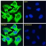 Volociximab Chimeric Recombinant Rabbit Monoclonal Antibody (M200 (Volociximab))
