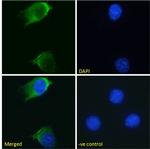 EGFR Chimeric Recombinant Rabbit Monoclonal Antibody (S3 12D)