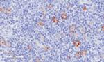 CD30 Chimeric Recombinant Rabbit Monoclonal Antibody (Ki-3)