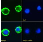 Lewis Y Chimeric Recombinant Mouse Monoclonal Antibody (BR96)