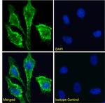 CD147 Recombinant Mouse Monoclonal Antibody (Ab-1)