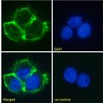 Matuzumab Chimeric Antibody in Immunocytochemistry (ICC/IF)