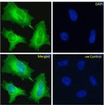EDB-FN Chimeric Antibody in Immunocytochemistry (ICC/IF)