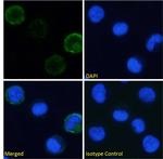CD49d (Integrin alpha 4) Chimeric Recombinant Rabbit Monoclonal Antibody (21.6)
