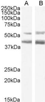 CCR4 (Mogamulizumab Biosimilar) Recombinant Rabbit Monoclonal Antibody (KW-0761 (Mogamulizumab))