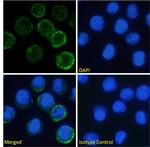 Tocilizumab Chimeric Recombinant Rabbit Monoclonal Antibody (rhPM-1 (Tocilizumab))