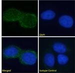 Ganglioside GM2 Chimeric Recombinant Rabbit Monoclonal Antibody (L55-81)