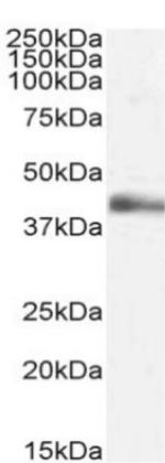 TNF beta Chimeric Recombinant Rabbit Monoclonal Antibody (3F12.2D3)