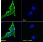 CD98 Recombinant Mouse Monoclonal Antibody (HBJ127)