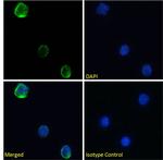 CD154 (CD40 Ligand) Chimeric Antibody in Immunocytochemistry (ICC/IF)
