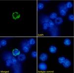 MHC Class I Chimeric Recombinant Rabbit Monoclonal Antibody (R1-21.2)
