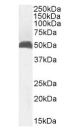 MHC Class I Chimeric Antibody in Western Blot (WB)