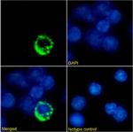 TCR alpha/beta Chimeric Recombinant Rabbit Monoclonal Antibody (Desire-1)