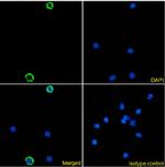 CLEC4A Chimeric Recombinant Rabbit Monoclonal Antibody (9E8)