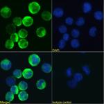 CSF2RB Chimeric Recombinant Rabbit Monoclonal Antibody (BION-1)