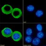 CCRL2 Chimeric Recombinant Rabbit Monoclonal Antibody (BZ5B8)