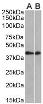CCRL2 Chimeric Antibody in Western Blot (WB)