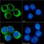 CCRL2 Chimeric Recombinant Rabbit Monoclonal Antibody (BZ2E3)
