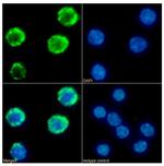 IFNGR1 (CD119) Chimeric Recombinant Rabbit Monoclonal Antibody (GR20)