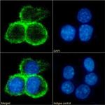 CD40 Chimeric Antibody in Immunocytochemistry (ICC/IF)