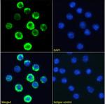 CD20 Chimeric Recombinant Rabbit Monoclonal Antibody (18B12)