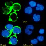 Minretumomab Recombinant Mouse Monoclonal Antibody (Minretumomab (CC49))