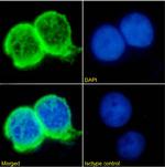 Minretumomab Chimeric Recombinant Rabbit Monoclonal Antibody (Minretumomab (CC49))