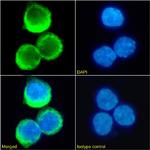 RHD Chimeric Recombinant Rabbit Monoclonal Antibody (D7C2)