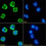 CD35 Chimeric Recombinant Rabbit Monoclonal Antibody (E11)