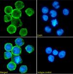 CD11a Chimeric Antibody in Immunocytochemistry (ICC/IF)