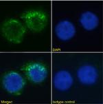 CD11a Chimeric Antibody in Immunocytochemistry (ICC/IF)