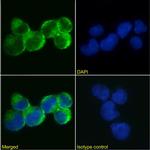 IL9R Chimeric Recombinant Rabbit Monoclonal Antibody (AH9R2)