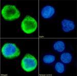 MS4A4A Chimeric Recombinant Rabbit Monoclonal Antibody (5C12)