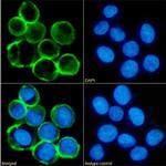 MS4A4A Chimeric Recombinant Rabbit Monoclonal Antibody (3F2)