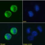 FceR1 alpha Chimeric Recombinant Rabbit Monoclonal Antibody (IB10)