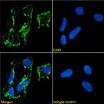 CD56 (NCAM) Recombinant Mouse Monoclonal Antibody (NCAM12.19)