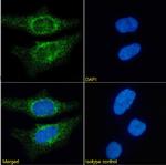 CD171 (L1CAM) Recombinant Mouse Monoclonal Antibody (L1-14.10)