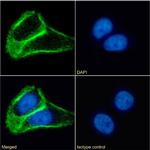 TSPAN1 Chimeric Recombinant Rabbit Monoclonal Antibody (4/12)