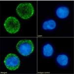 CD10 Chimeric Antibody in Immunocytochemistry (ICC/IF)