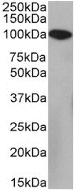 CD10 Chimeric Antibody in Western Blot (WB)