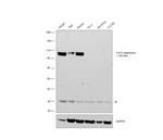 CD10 Chimeric Antibody in Western Blot (WB)