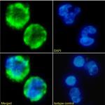 VCAM-1 (CD106) Chimeric Antibody in Immunocytochemistry (ICC/IF)