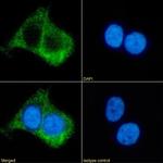 beta-2 Adrenergic Receptor Chimeric Recombinant Rabbit Monoclonal Antibody (R11/E1)