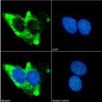 beta-2 Adrenergic Receptor Chimeric Recombinant Rabbit Monoclonal Antibody (13D6)