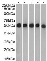Cytokeratin 7 Chimeric Antibody in Western Blot (WB)