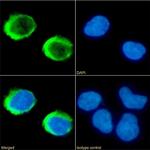 Toralizumab Chimeric Antibody in Immunocytochemistry (ICC/IF)