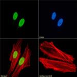 H4ac pan-acetyl (K8,K12,K16) Chimeric Recombinant Rabbit Monoclonal Antibody (KM-2)
