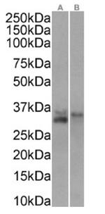 CD74 Chimeric Antibody in Western Blot (WB)